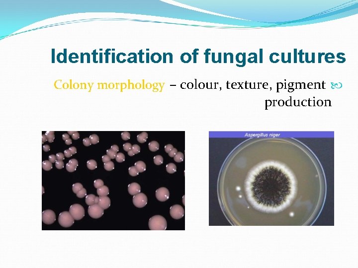 Identification of fungal cultures Colony morphology – colour, texture, pigment production 