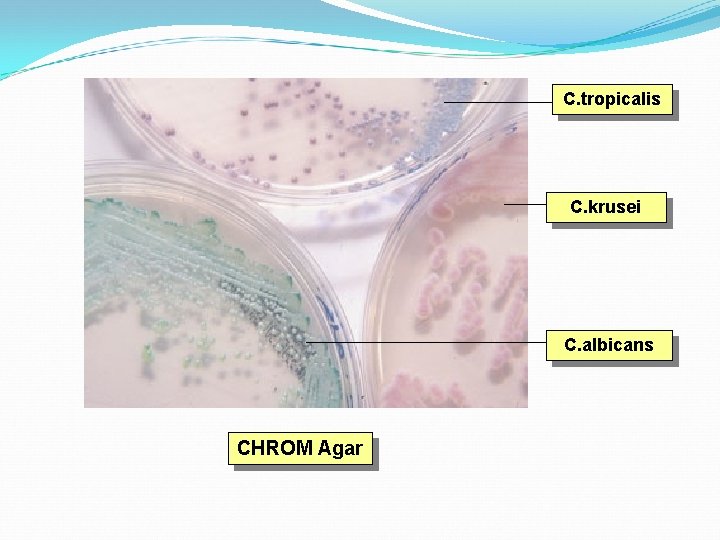 C. tropicalis C. krusei C. albicans CHROM Agar 