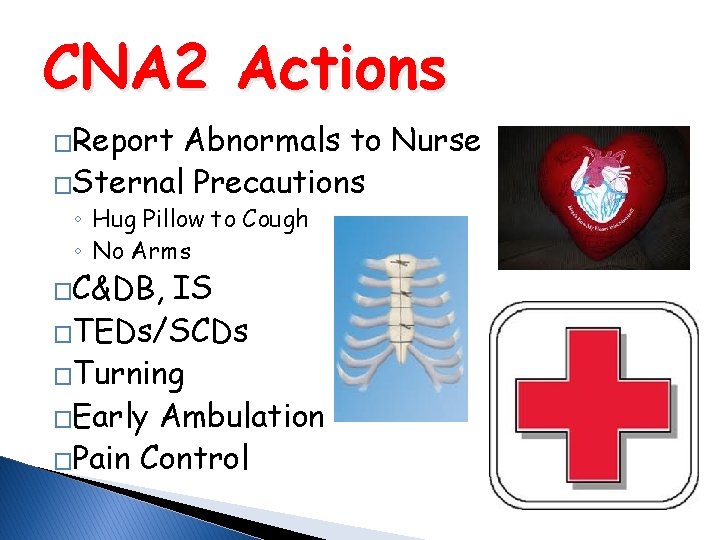 CNA 2 Actions �Report Abnormals to Nurse �Sternal Precautions ◦ Hug Pillow to Cough