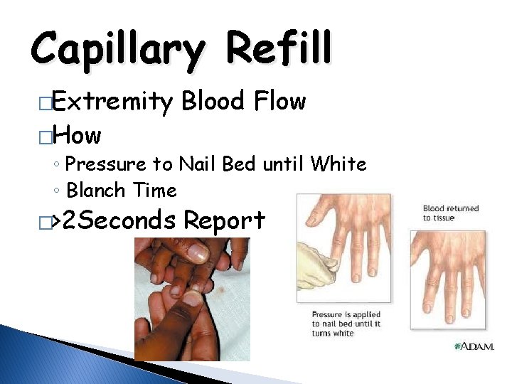 Capillary Refill �Extremity �How Blood Flow ◦ Pressure to Nail Bed until White ◦