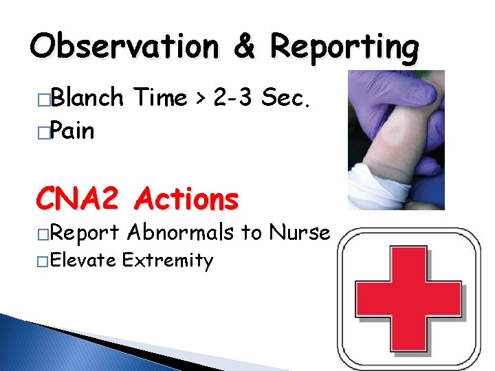 Observation & Reporting �Blanch �Pain Time > 2 -3 Sec. CNA 2 Actions �Report