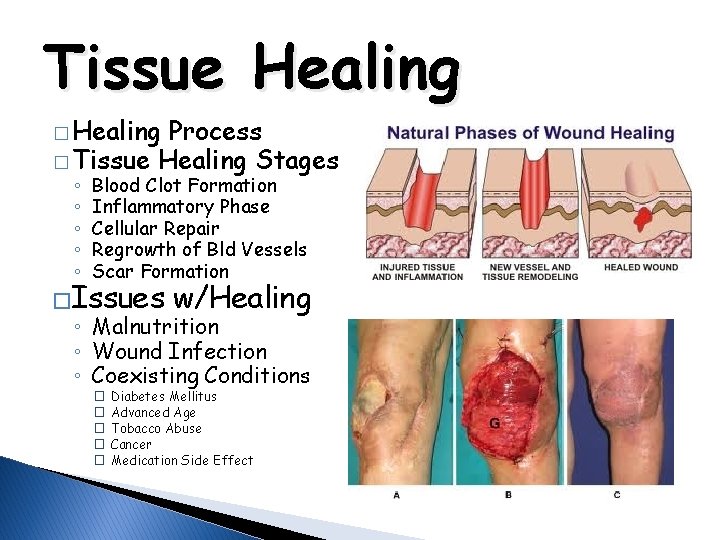 Tissue Healing � Healing Process � Tissue Healing Stages ◦ ◦ ◦ Blood Clot