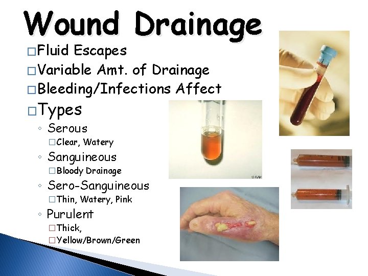 Wound Drainage � Fluid Escapes � Variable Amt. of Drainage � Bleeding/Infections Affect �Types