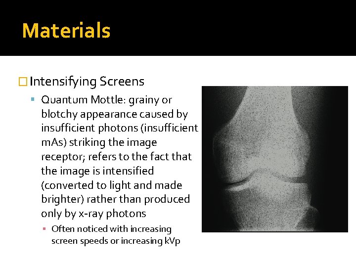 Materials � Intensifying Screens Quantum Mottle: grainy or blotchy appearance caused by insufficient photons
