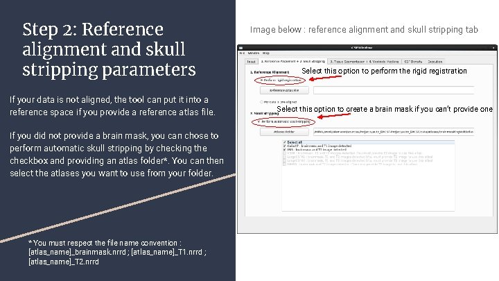 Step 2: Reference alignment and skull stripping parameters If your data is not aligned,