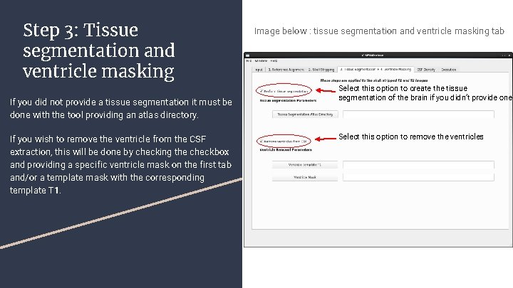 Step 3: Tissue segmentation and ventricle masking If you did not provide a tissue