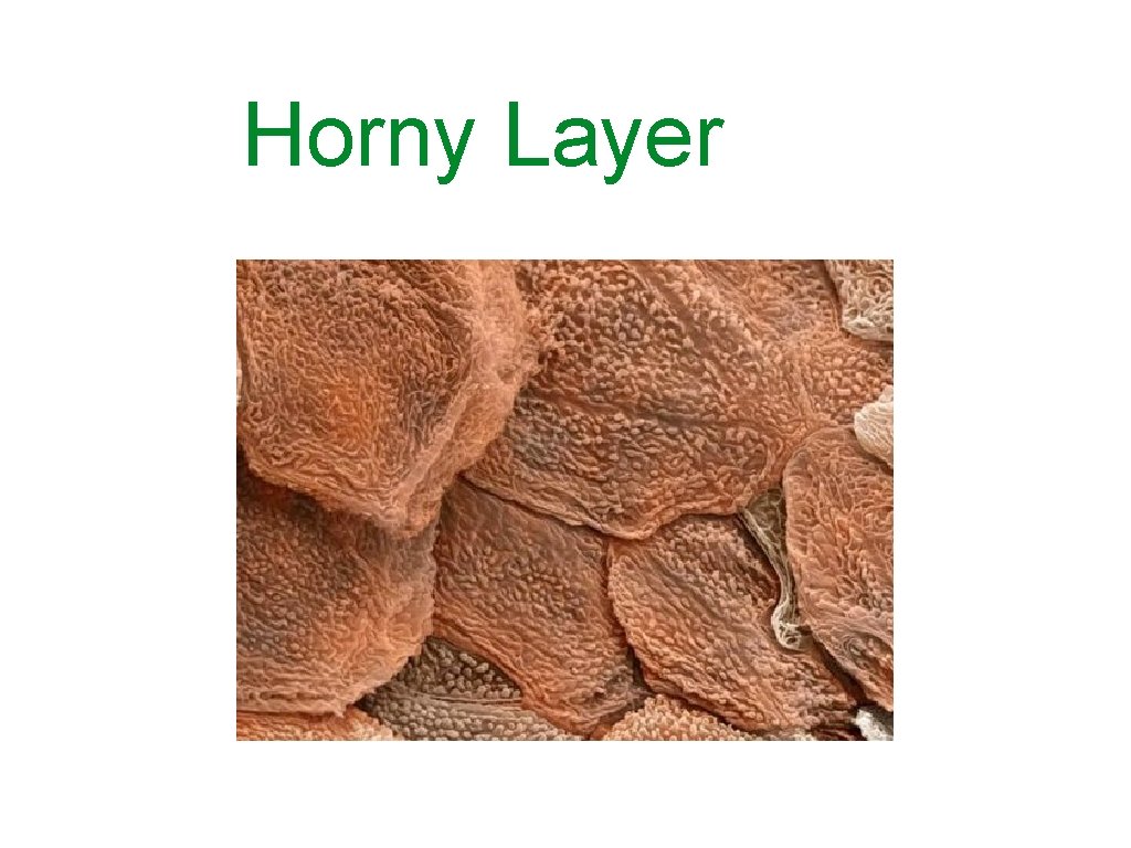 Horny Layer 