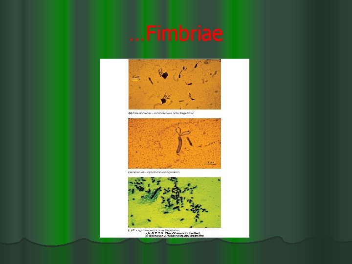 …Fimbriae 