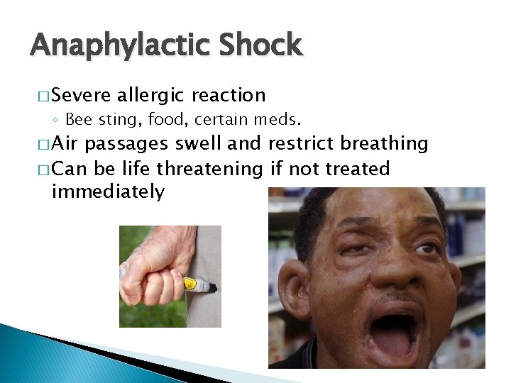 Anaphylactic Shock � Severe allergic reaction ◦ Bee sting, food, certain meds. � Air