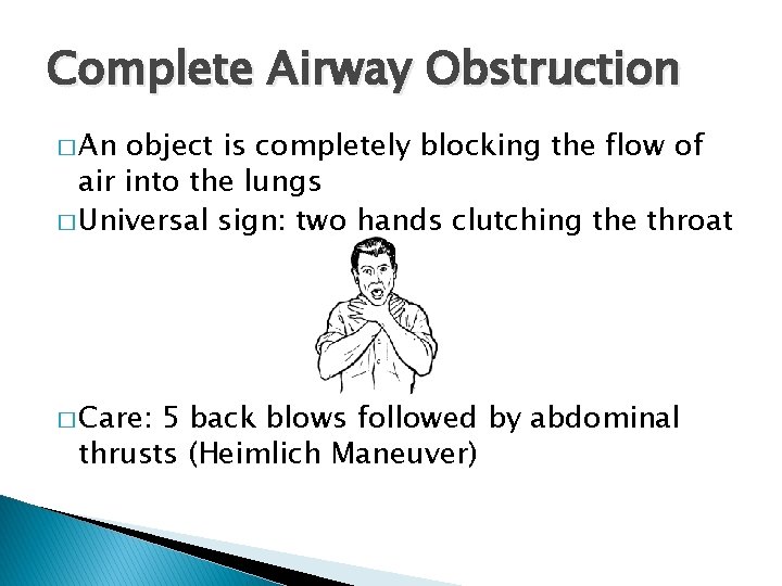 Complete Airway Obstruction � An object is completely blocking the flow of air into