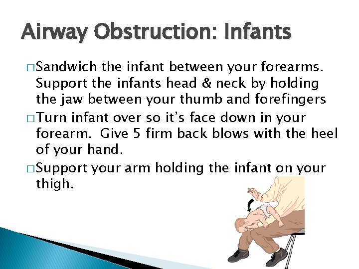 Airway Obstruction: Infants � Sandwich the infant between your forearms. Support the infants head