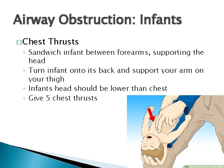 Airway Obstruction: Infants � Chest Thrusts ◦ Sandwich infant between forearms, supporting the head