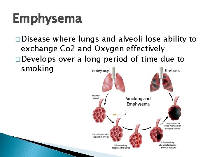 Emphysema � Disease where lungs and alveoli lose ability to exchange Co 2 and