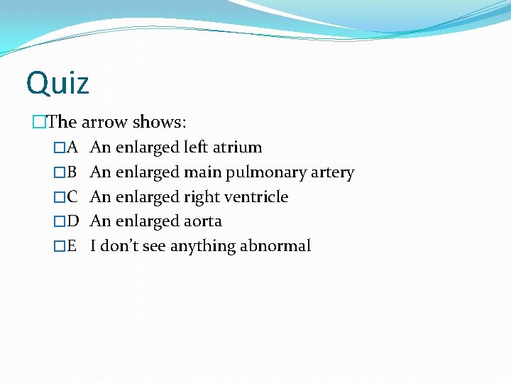 Quiz �The arrow shows: �A An enlarged left atrium �B An enlarged main pulmonary