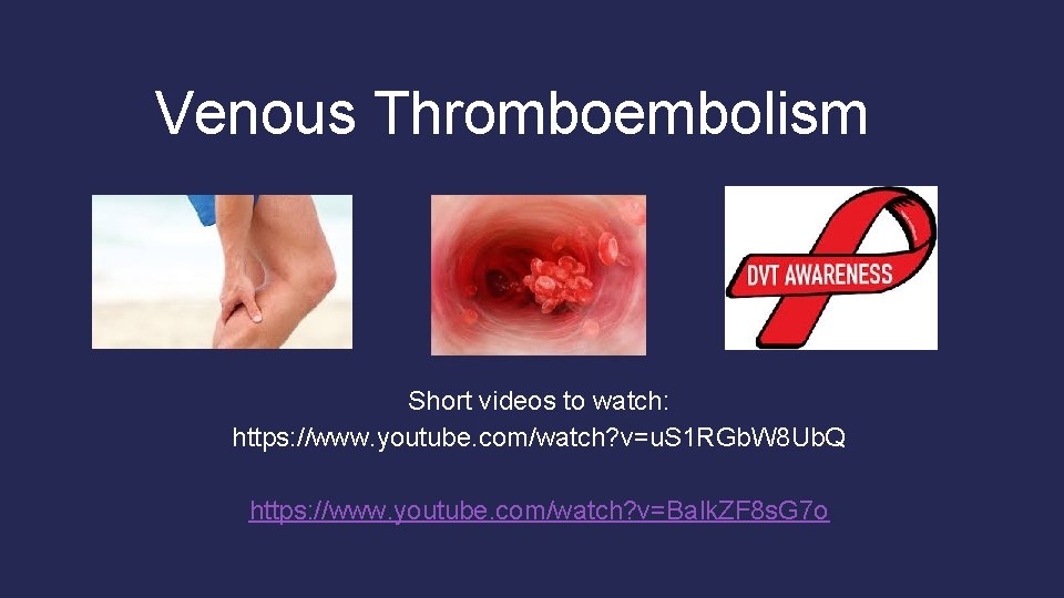 Venous Thromboembolism Short videos to watch: https: //www. youtube. com/watch? v=u. S 1 RGb. Venous Thromboembolism Short videos to watch: https: //www. youtube. com/watch? v=u. S 1 RGb.
