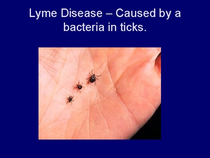 Lyme Disease – Caused by a bacteria in ticks. 