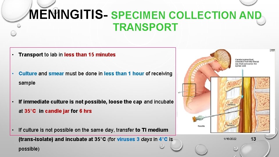 MENINGITIS- SPECIMEN COLLECTION AND TRANSPORT • Transport to lab in less than 15 minutes