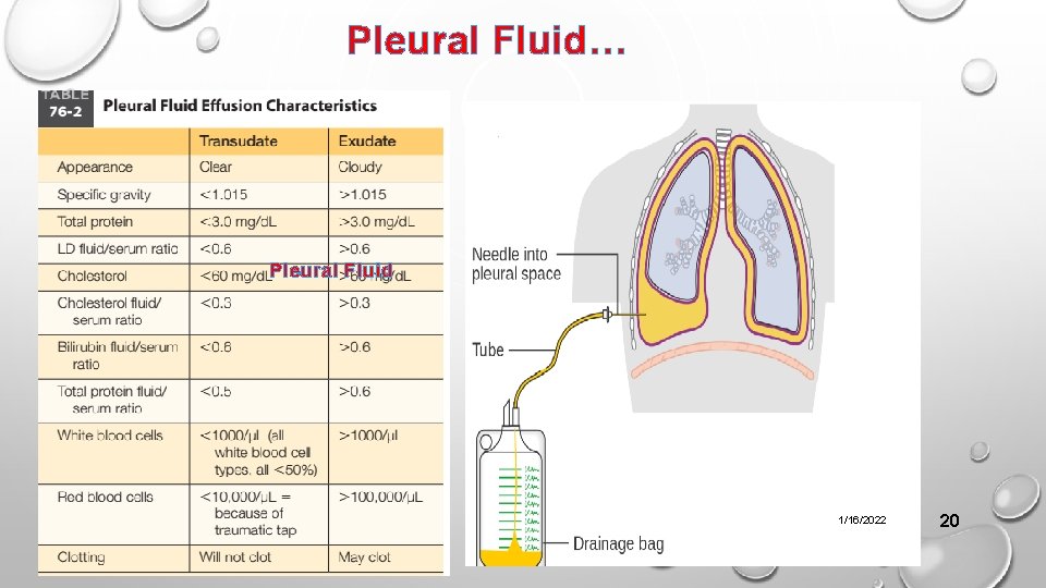 Pleural Fluid… Pleural Fluid 1/16/2022 20 