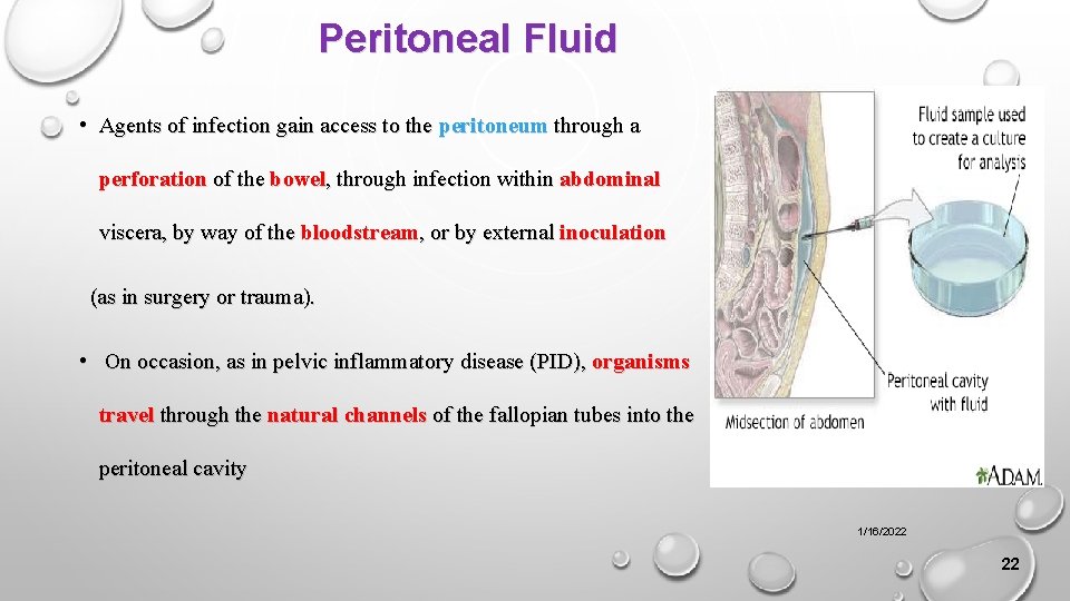 Peritoneal Fluid • Agents of infection gain access to the peritoneum through a perforation