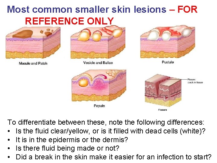 Most common smaller skin lesions – FOR REFERENCE ONLY To differentiate between these, note