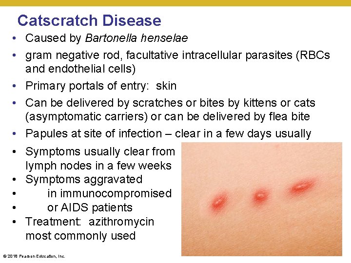 Catscratch Disease • Caused by Bartonella henselae • gram negative rod, facultative intracellular parasites