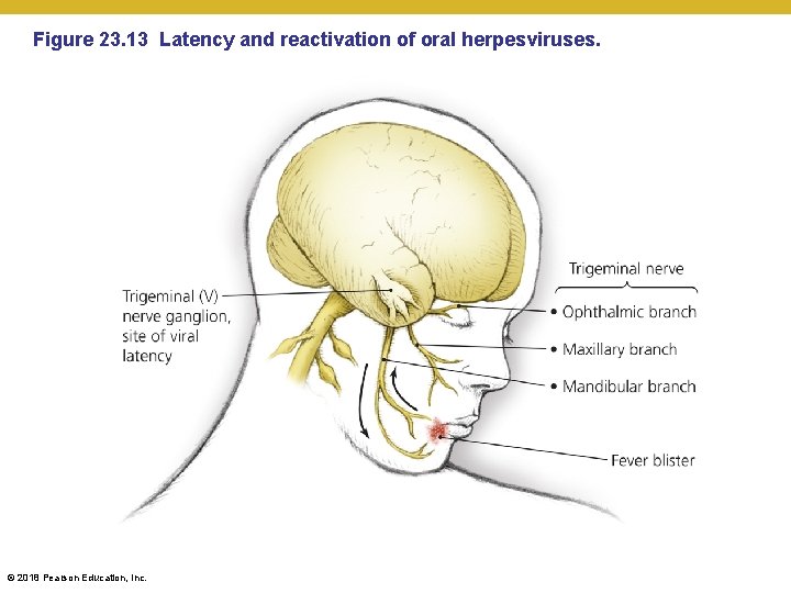 Figure 23. 13 Latency and reactivation of oral herpesviruses. © 2018 Pearson Education, Inc.