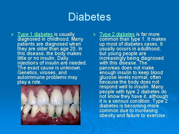 Diabetes Ø Type 1 diabetes is usually diagnosed in childhood. Many patients are diagnosed