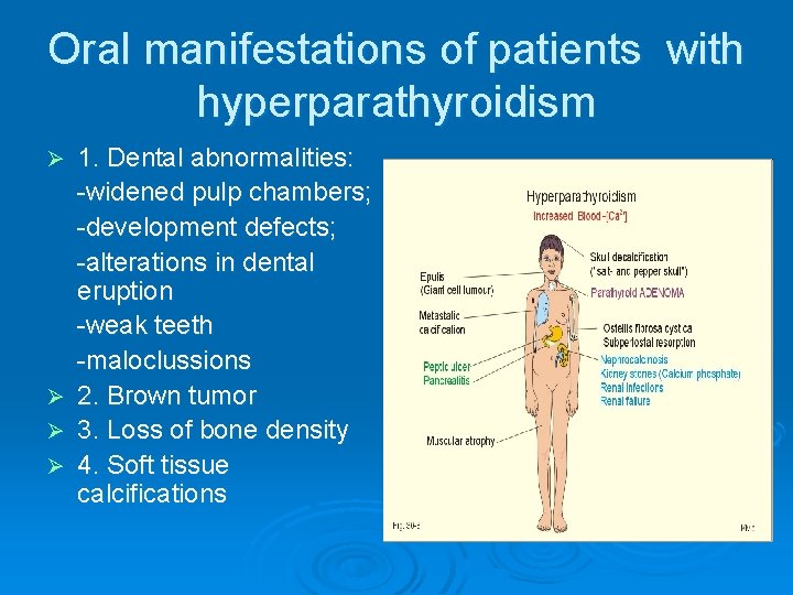 Oral manifestations of patients with hyperparathyroidism 1. Dental abnormalities: -widened pulp chambers; -development defects;