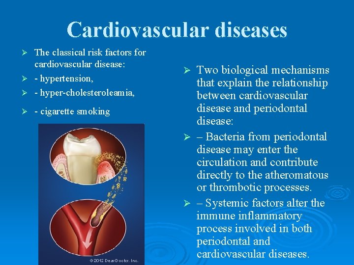 Cardiovascular diseases The classical risk factors for cardiovascular disease: Ø - hypertension, Ø -