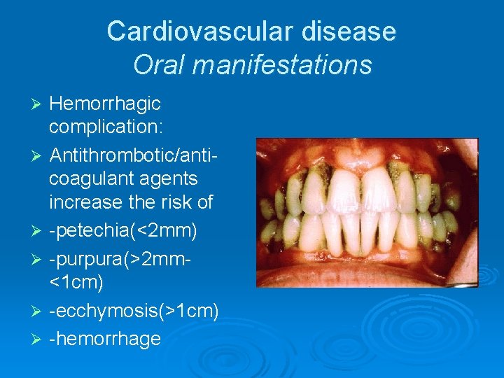 Cardiovascular disease Oral manifestations Hemorrhagic complication: Ø Antithrombotic/anticoagulant agents increase the risk of Ø