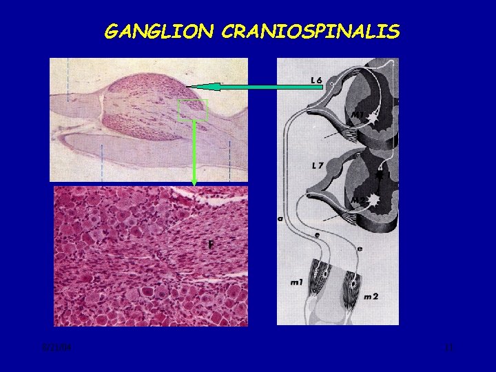 GANGLION CRANIOSPINALIS 8/21/04 11 