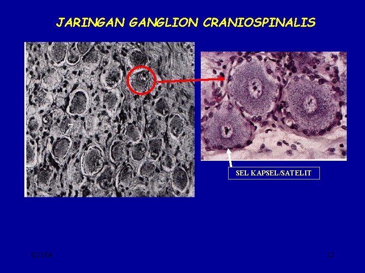 JARINGAN GANGLION CRANIOSPINALIS 7 SEL KAPSEL/SATELIT 8/21/04 12 