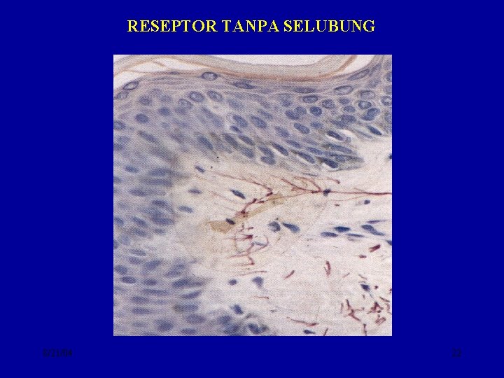 RESEPTOR TANPA SELUBUNG 8/21/04 22 