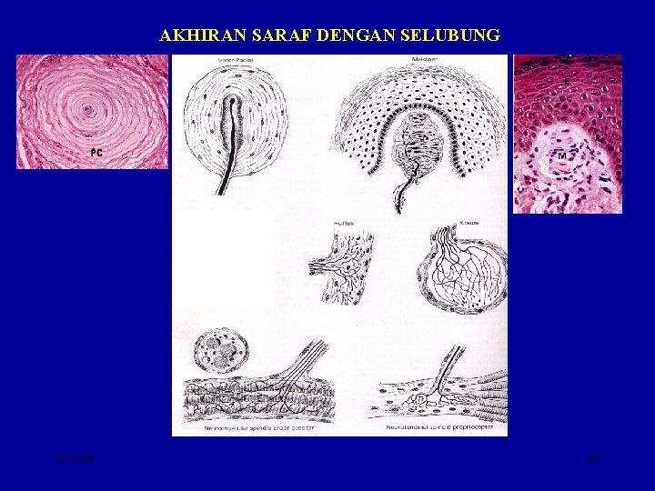 AKHIRAN SARAF DENGAN SELUBUNG 8/21/04 23 