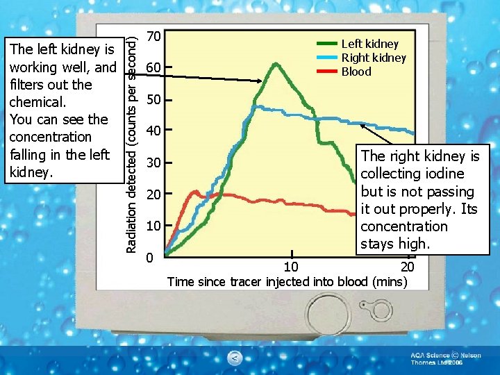 Radiation detected (counts per second) The left kidney is working well, and filters out
