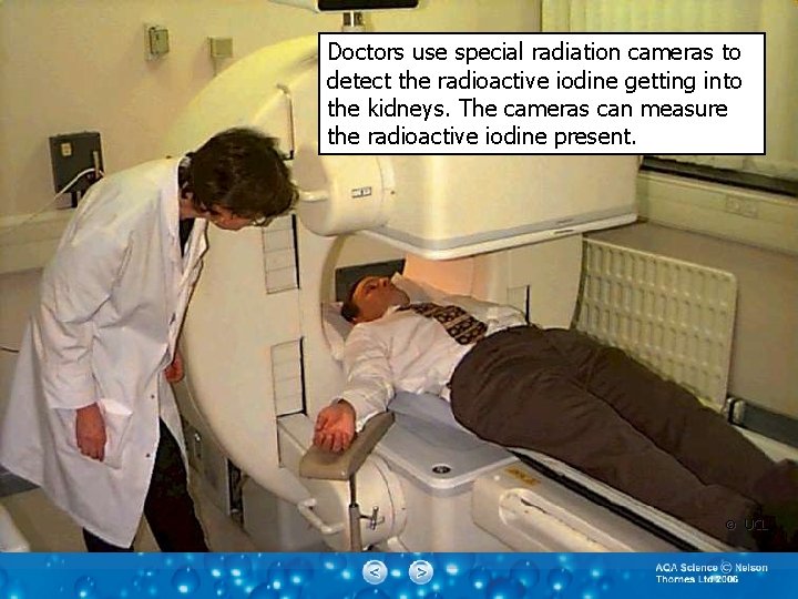 Doctors use special radiation cameras to detect the radioactive iodine getting into the kidneys.