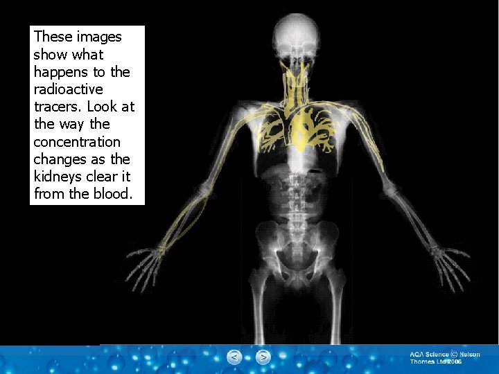 These images show what happens to the radioactive tracers. Look at the way the