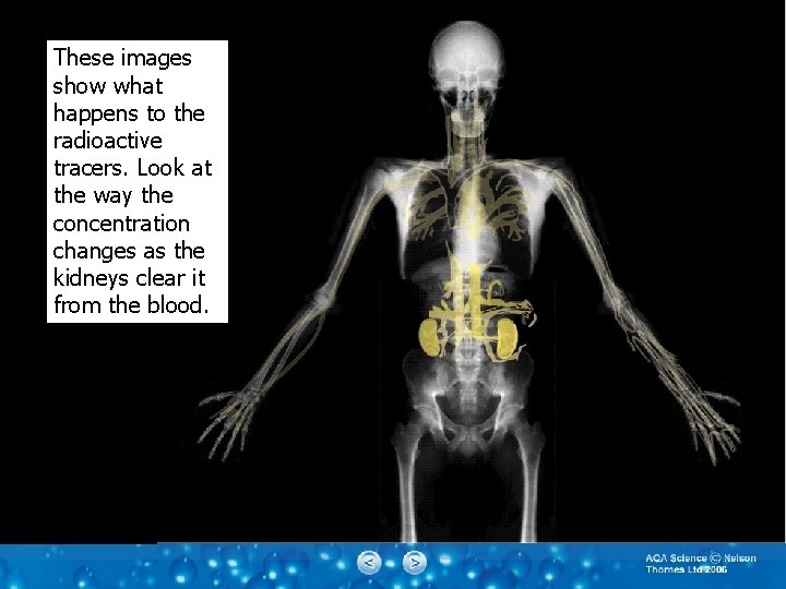 These images show what happens to the radioactive tracers. Look at the way the