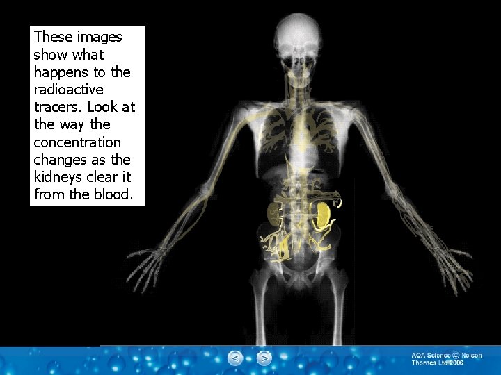 These images show what happens to the radioactive tracers. Look at the way the