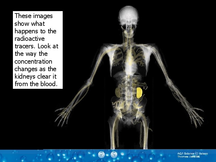 These images show what happens to the radioactive tracers. Look at the way the