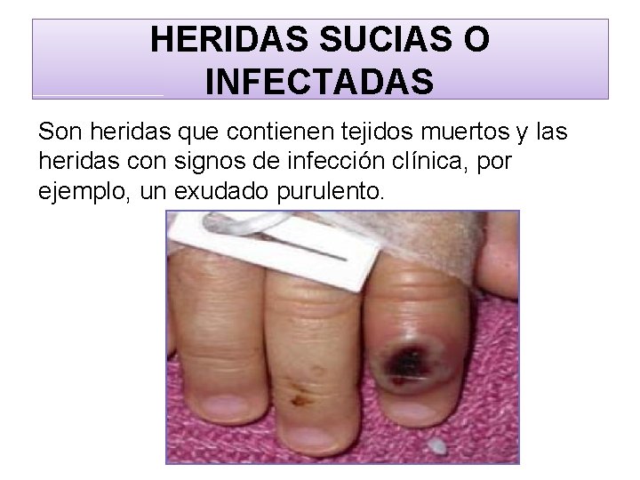 HERIDAS SUCIAS O INFECTADAS Son heridas que contienen tejidos muertos y las heridas con
