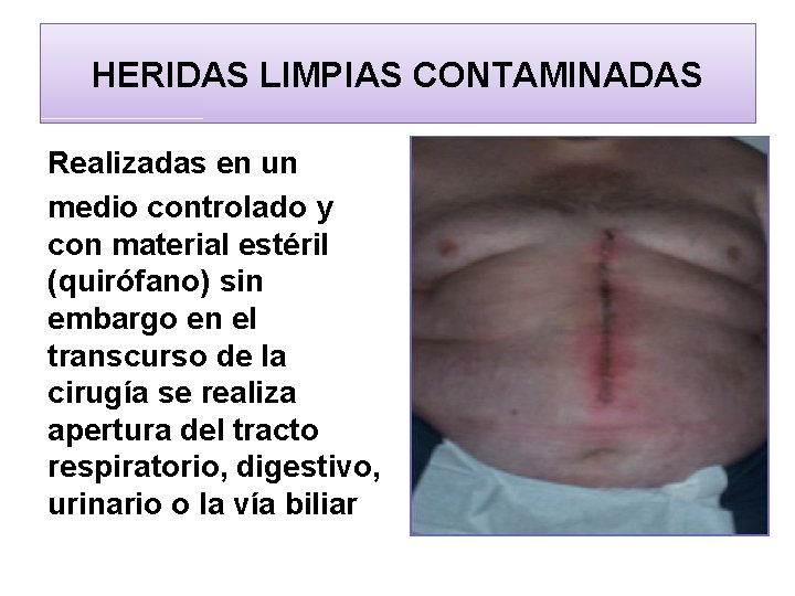 HERIDAS LIMPIAS CONTAMINADAS Realizadas en un medio controlado y con material estéril (quirófano) sin