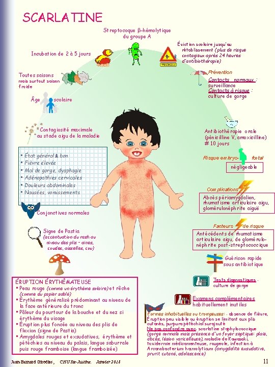 SCARLATINE Streptocoque b-hémolytique du groupe A Éviction scolaire jusqu'au rétablissement (plus de risque contagieux SCARLATINE Streptocoque b-hémolytique du groupe A Éviction scolaire jusqu'au rétablissement (plus de risque contagieux