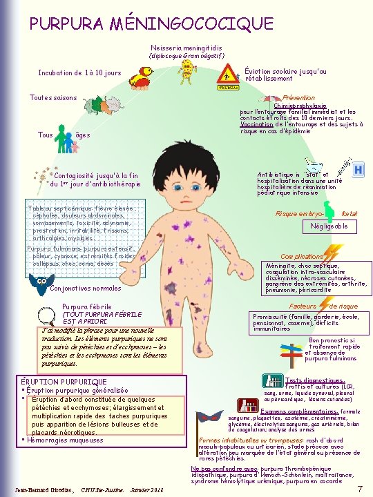 PURPURA MÉNINGOCOCIQUE Neisseria meningitidis (diplocoque Gram négatif) Éviction scolaire jusqu'au rétablissement Incubation de 1 PURPURA MÉNINGOCOCIQUE Neisseria meningitidis (diplocoque Gram négatif) Éviction scolaire jusqu'au rétablissement Incubation de 1