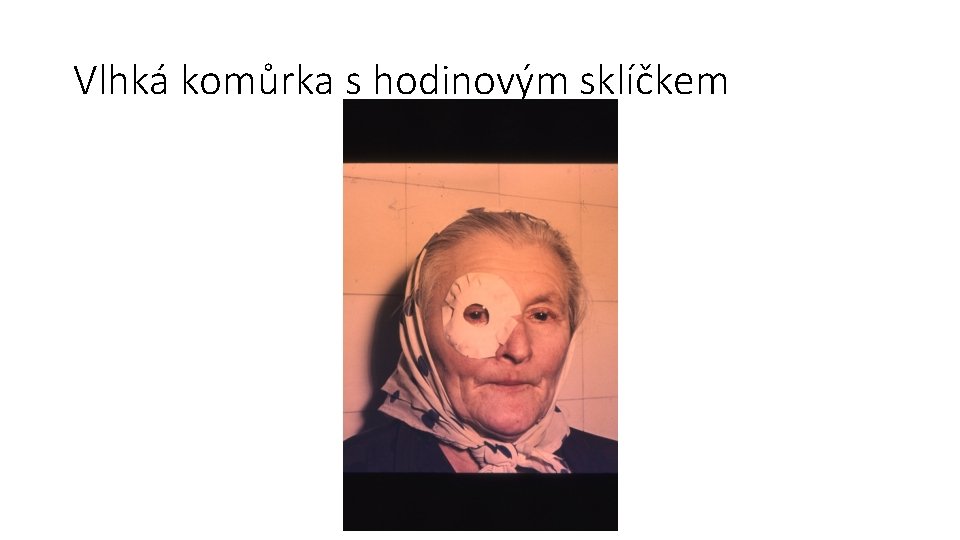 Vlhká komůrka s hodinovým sklíčkem 