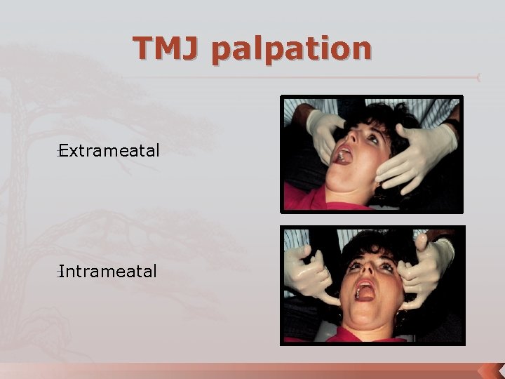 TMJ palpation Extrameatal � Intrameatal � 