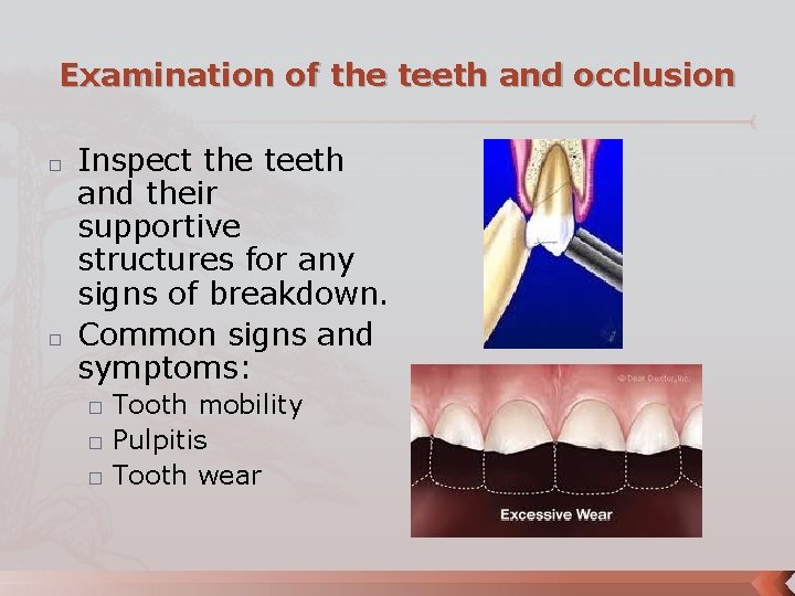 Examination of the teeth and occlusion � � Inspect the teeth and their supportive