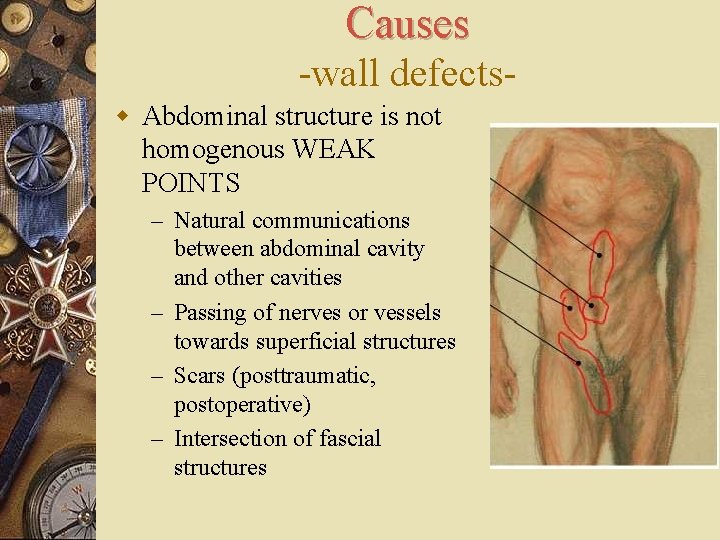 Causes -wall defectsw Abdominal structure is not homogenous WEAK POINTS – Natural communications between