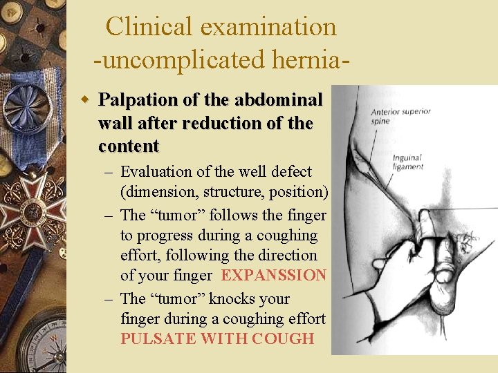 Clinical examination -uncomplicated herniaw Palpation of the abdominal wall after reduction of the content
