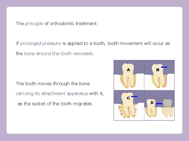 The principle of orthodontic treatment: if prolonged pressure is applied to a tooth, tooth